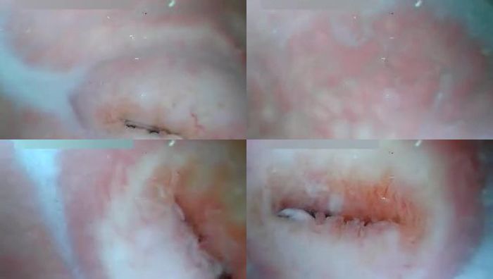 蓝色面具系列020